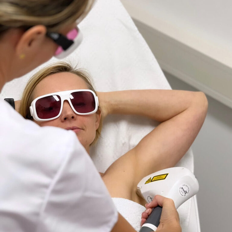 Eine Frau mit Sonnenbrille erhält eine Haarentfernung an der Achsel unter Anleitung einer Fachkraft.