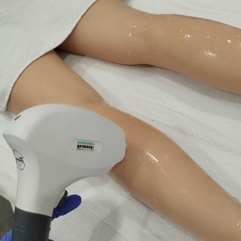 Eine behandelnde Person nutzt ein Gerät zur Hautbehandlung an den Beinen eines Modellkörpers, der auf einem weißen Tuch liegt.